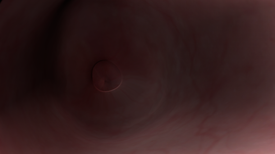 Uterus